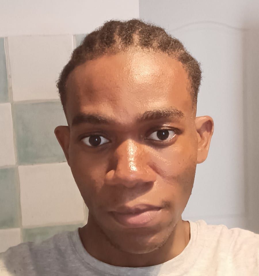 Profil de Thoma